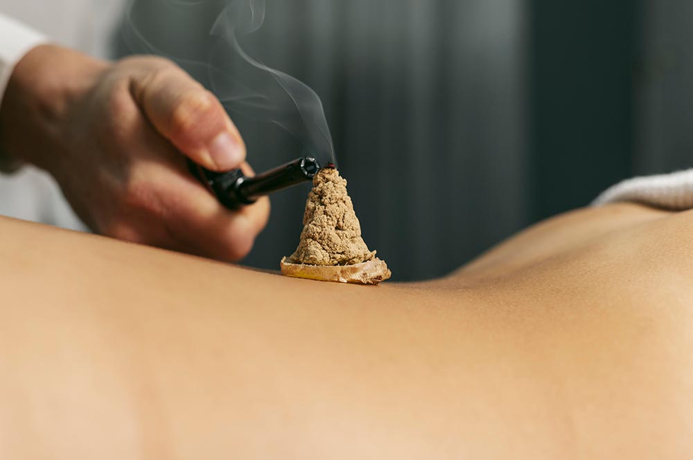 Moxibustion